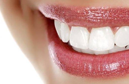 cristal-white-blanchiment-dentaire